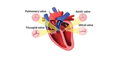 EVOLUTION OF HEART-VALVE REPAIR