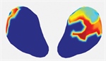 MAPPING LABOR CONTRACTIONS IN REAL TIME