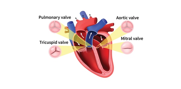 EVOLUTION OF HEART-VALVE REPAIR