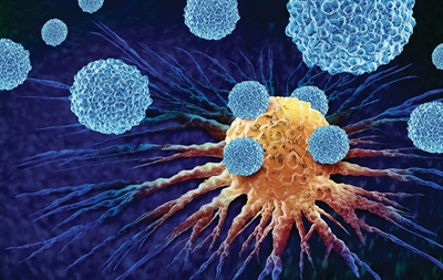 NEW CELL-BASED IMMUNOTHERAPY TREATS MELANOMA