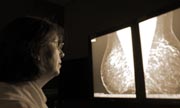 Digital Mammography